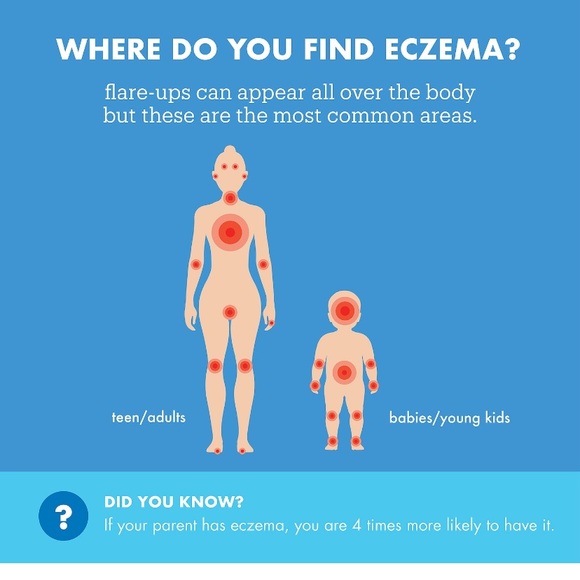 🆕🔥HOST PICKS Skin-fix Foaming Oil Body Wash - eczema care - Picture 4 of 6